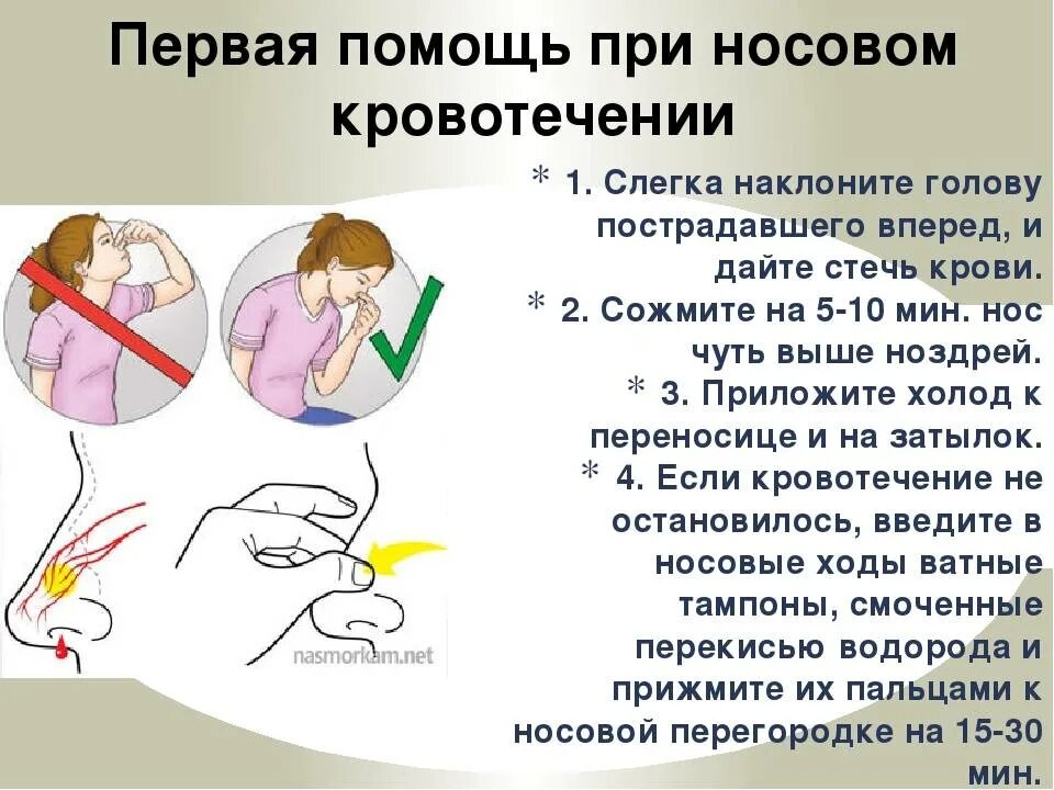 При массовом кровотечении. Остановка родового кровотечения. Как Остановить кровб из роса. Как Остановить кровь из носа. Сильно текут что делать