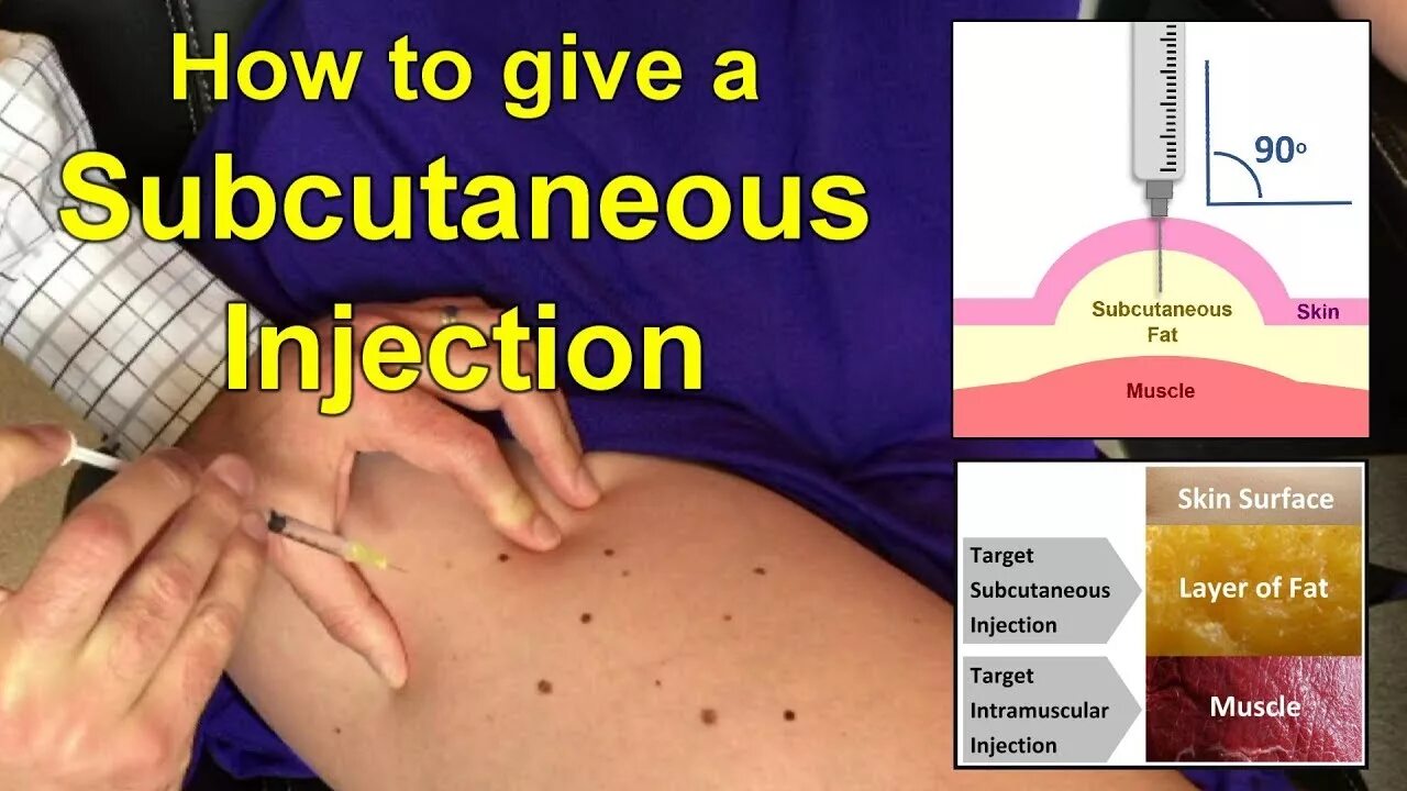How to inject wave. Subcutaneous injection technique.