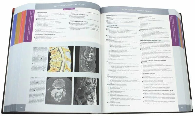 «медицинская радиология», 2000 г. Учебники по лучевой диагностике позвоночника. Лучевая диагностика pdf. Синдром верхней грудной апертуры. Рентгенология учебник.