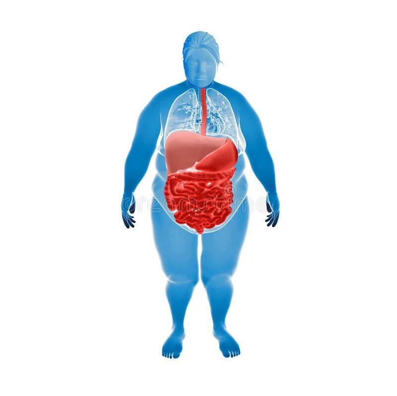 Пищеварительная система ожирение. Метаболический синдром иллюстрации. Метаболический синдром толстый.
