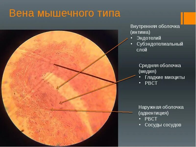 Вены мышечного типа примеры Сердечно-сосудистая система Препараты 1 Артерия мышечного типа Окраска