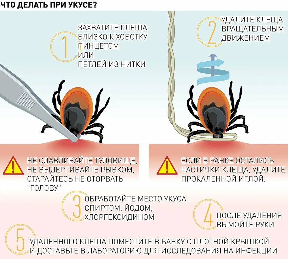 Зачем нужны клещи. Клещи. Места присасывания клеща схема.