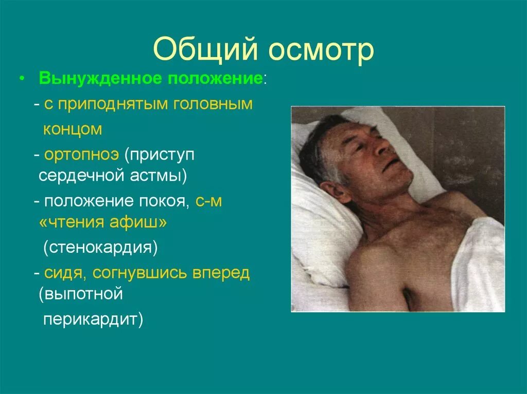 Занимающими положение. Положение пациента при приступе стенокардии. вынужденное положение пациента. стенокардия вынужденное положение. вынужденное положение при приступе стенокардии.