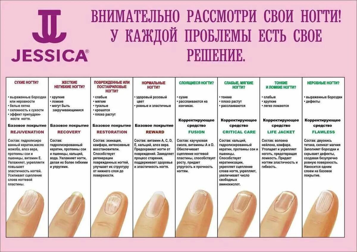 Что означают полосы на ногтях. Таблица заболевания ногтевой пластины. Диагностика поноктям рук. Заболевания по ногтям рук. Диагностика по ногтям.