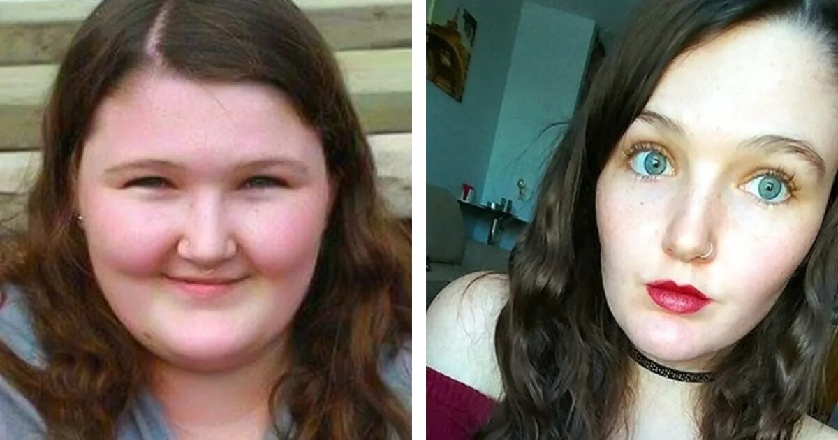 Когда ее лицо становилось лучше. Лицо до и после похудения. Лицо до и после похудения девушки. Щеки после похудения до и после. Толстое лицо.