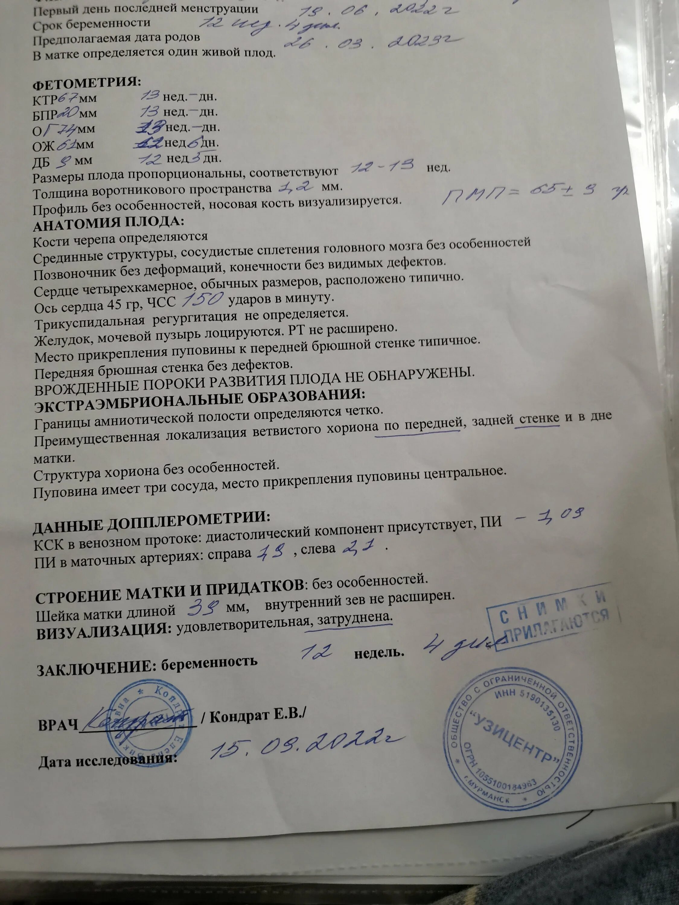 Роддом 1 скрининг. Первый скрининг. скрининг по беременности. что делают на скрининге. 1 скрининг 1/6099 риск 2 скрининг 1/67.