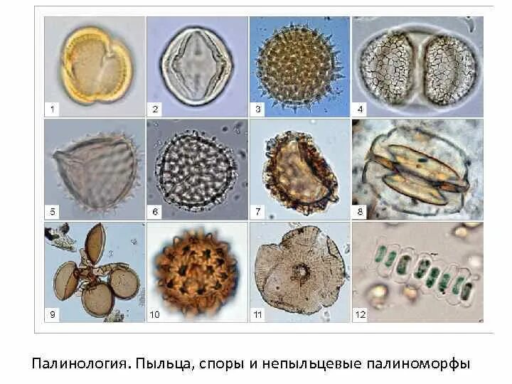 Пыльца микроскопия палинология. Непыльцевые палиноморфы. Споры и пыльца. Спорово пыльцевой метод в археологии. Пыльца и споры