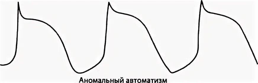 Повышенный автоматизм
