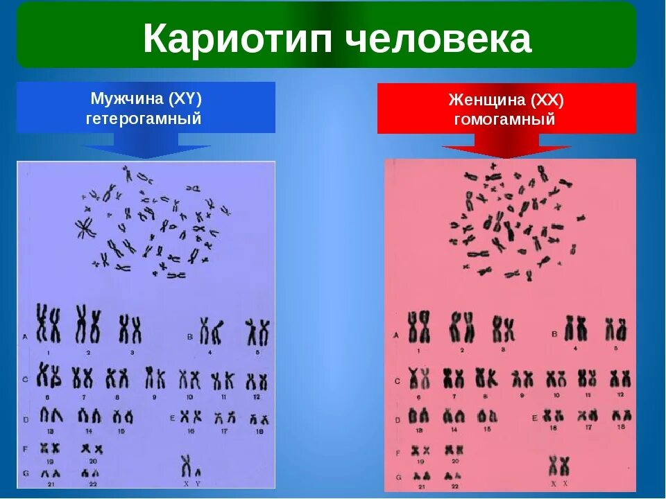 Кариотип человека определяют. Кариотип. Кариотип человека. Кариотип мужчины. Нормальный кариотип.