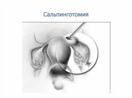 Маточные операции название