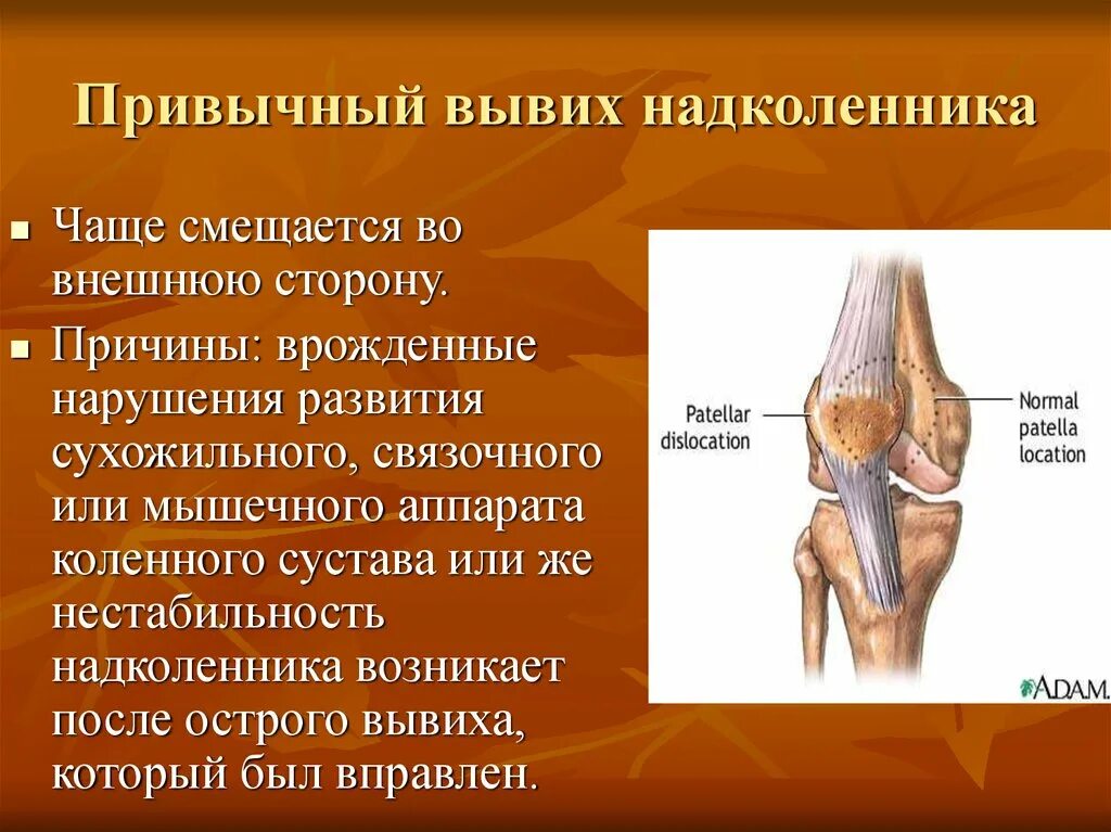 Растяжение связок сустава мкб