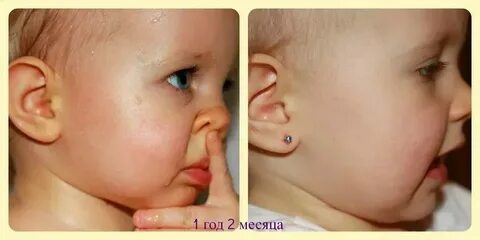 Сколько заживают уши у ребенка