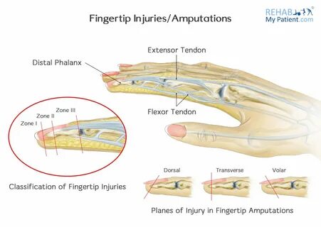 Fingertips