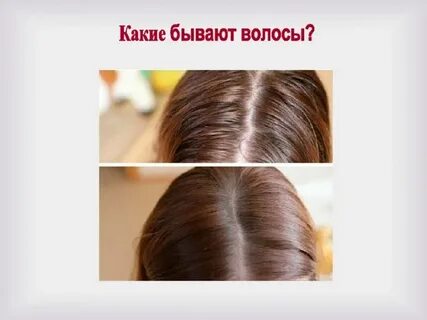Волосы бывают