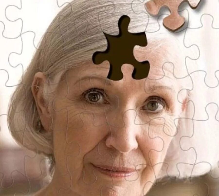 Слабоумие картинки. Старение мозга. Нарушение памяти у пожилых. Мозг стареет. Психическая старость.