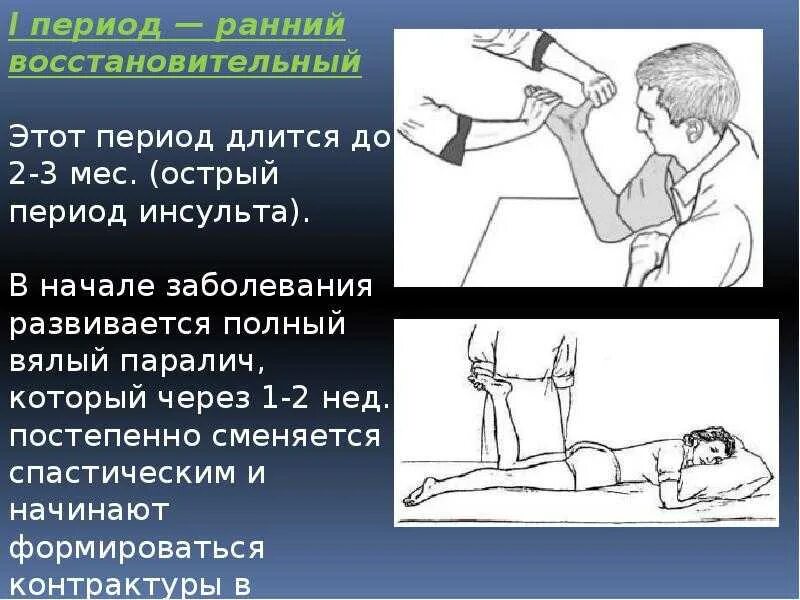 Инсульт гимнастика руки. Упражнения для реабилитации после инсульта. Упражнения после инсульта для восстановления. Методика ЛФК при инсульте. ЛФК И массаж после инсульта.