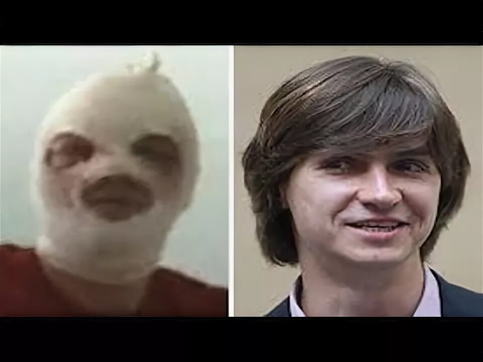 Сергей филин фото до и после операции Биография Сергея Филина РИА Новости, 29.02.2020