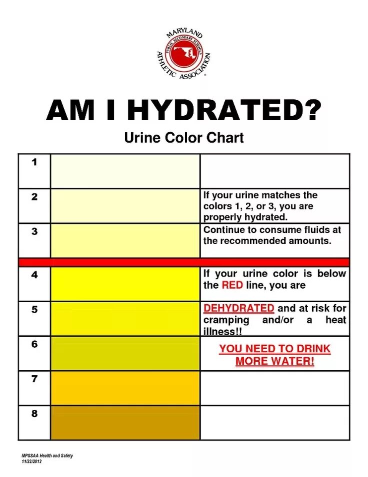 Почему моча ярко лимонного. Ярко желтая моча. Желтый цвет мочи. Urine Color Chart. Яркий желтый цвет мочи.