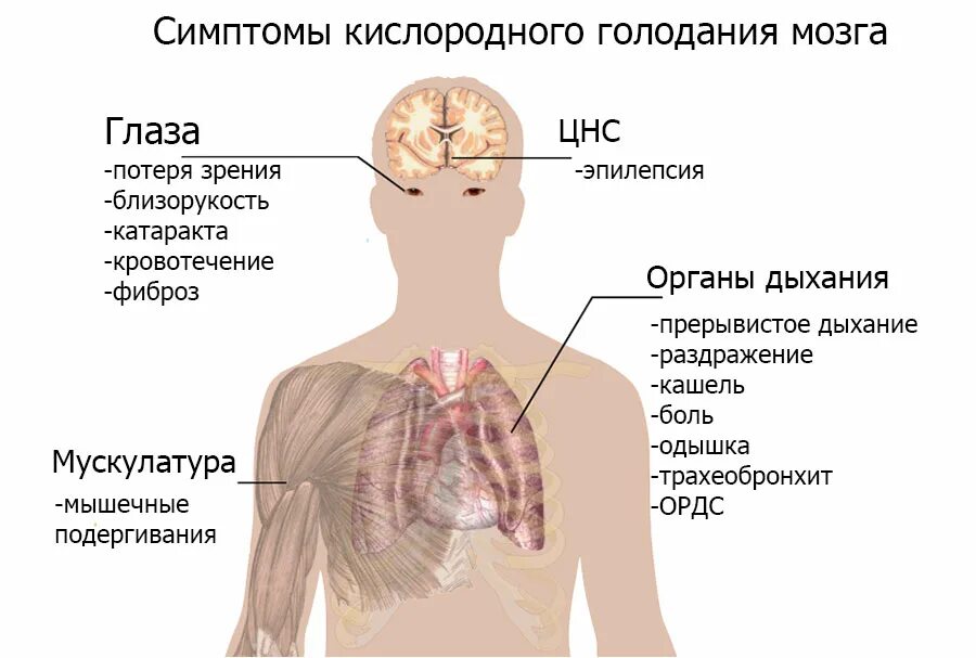 Поступление воздуха в кровь. Кислородное голодание мозга симптомы у взрослых. Кислородное голодание симптомы у взрослых. Признаки гипоксии головного мозга. Безкислороднте голодание.