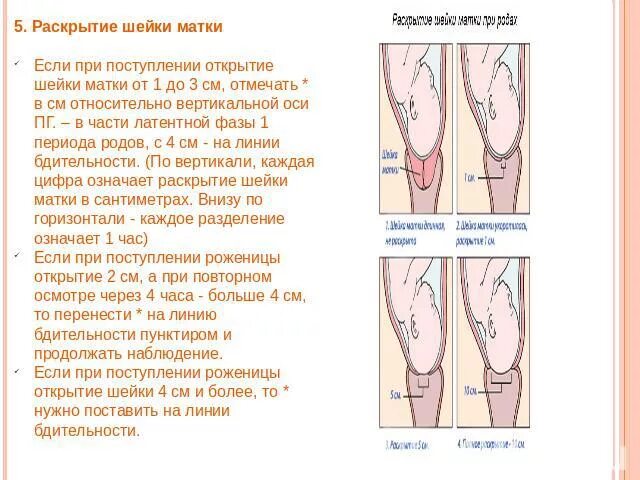 Плотная шейка. Раскрытие шейки матки 1.5 пальца. Шейка матки раскрытие 1.5 см. При родах открытие матки 3.