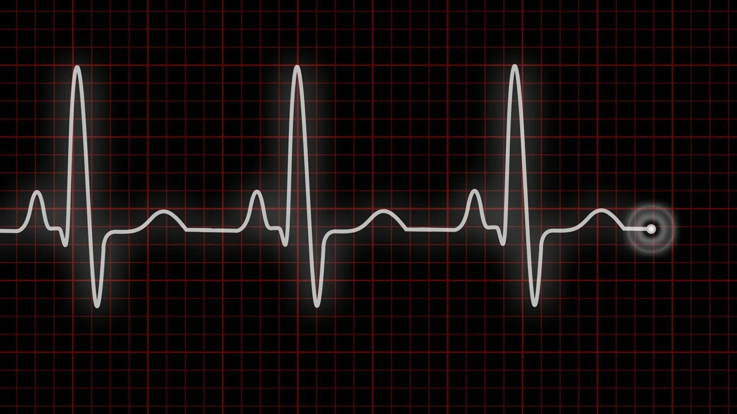 Усилилось сердцебиение. Пульс на ЭКГ. Сердцебиение кардиограмма. Пульсация сердца. ЭКГ на черном фоне.