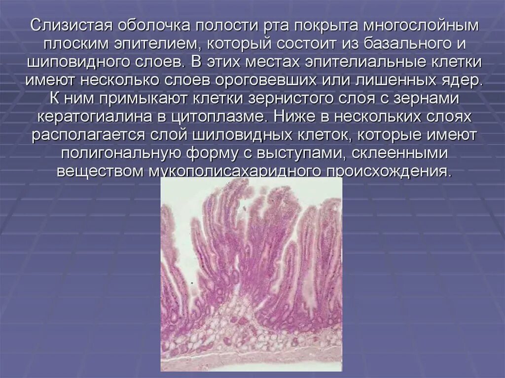 Слизистая оболочка полости рта строение. Слизистая оболочка ротовой полости гистология. Слизистая полости рта гистология. Гистология слизистой ротовой полости. Свойства слизистых оболочек