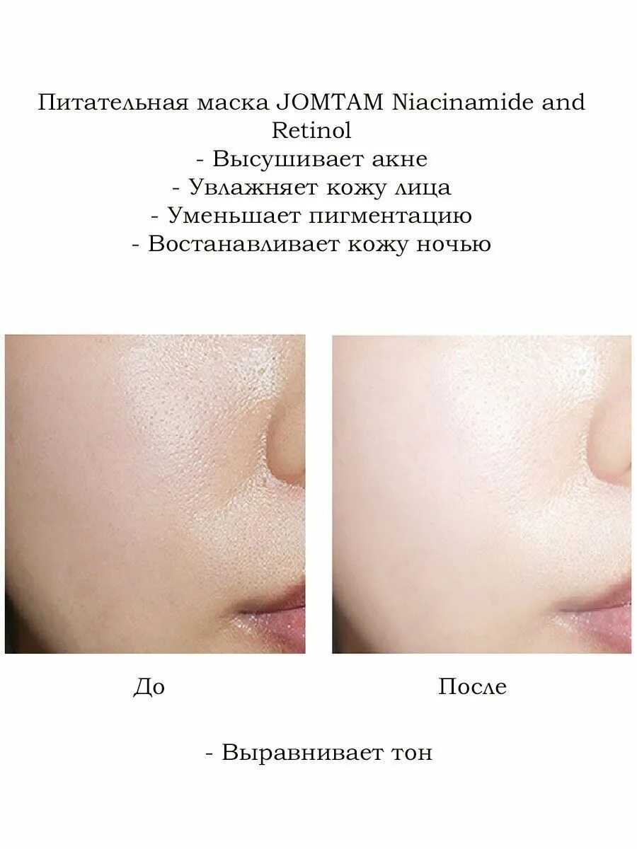 Набор масок jomtam Niacinamide and Retinol moisturize Elastic no Wash Mask 30 шт по 2 г. Маска для лица jomtam Niacinamide and Retinol moisturize Elastic no Wash Mask. Jomtam маска для лица питательная несмываемая. Jomtam набор питательных несмываемых масок с подтягивающим эффектом.