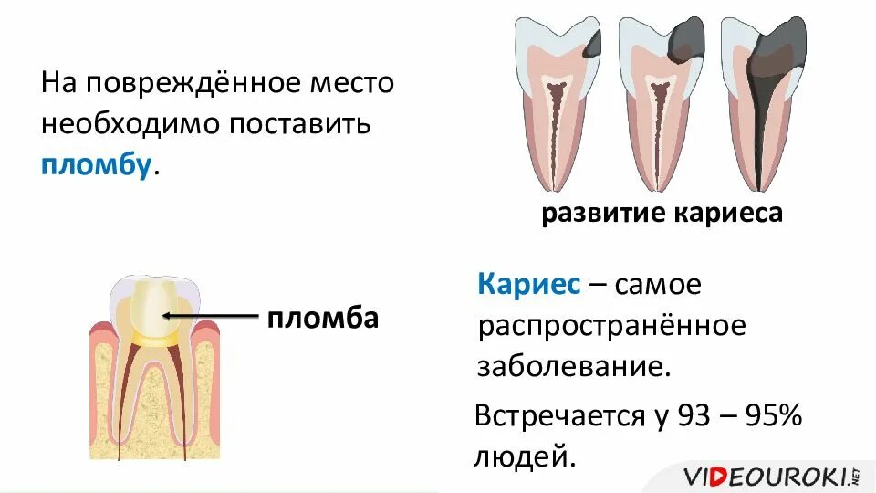 Строение зуба человека кариес. Строение зуба человека схема кариес.