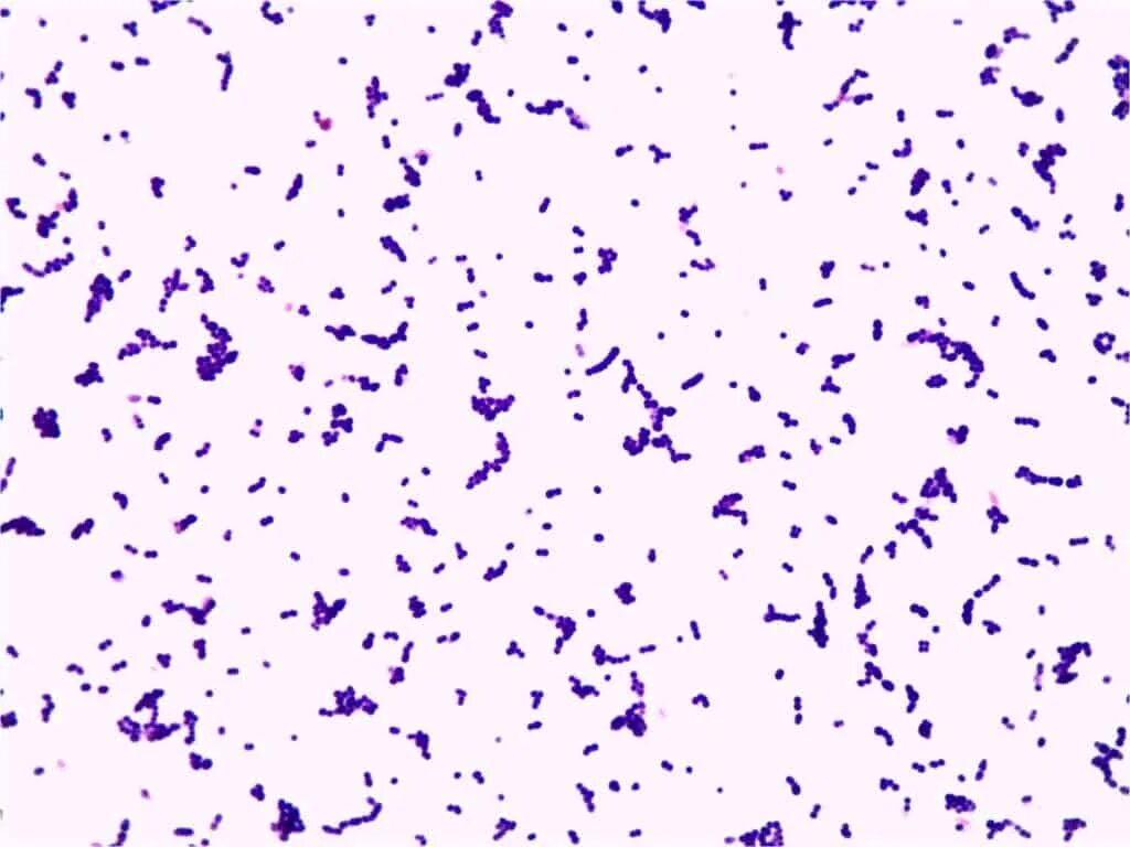 Streptococcus