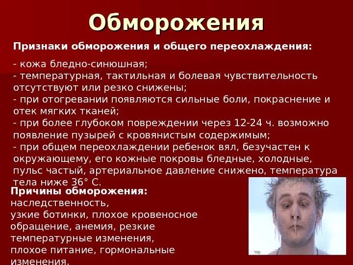 Обморожение определение