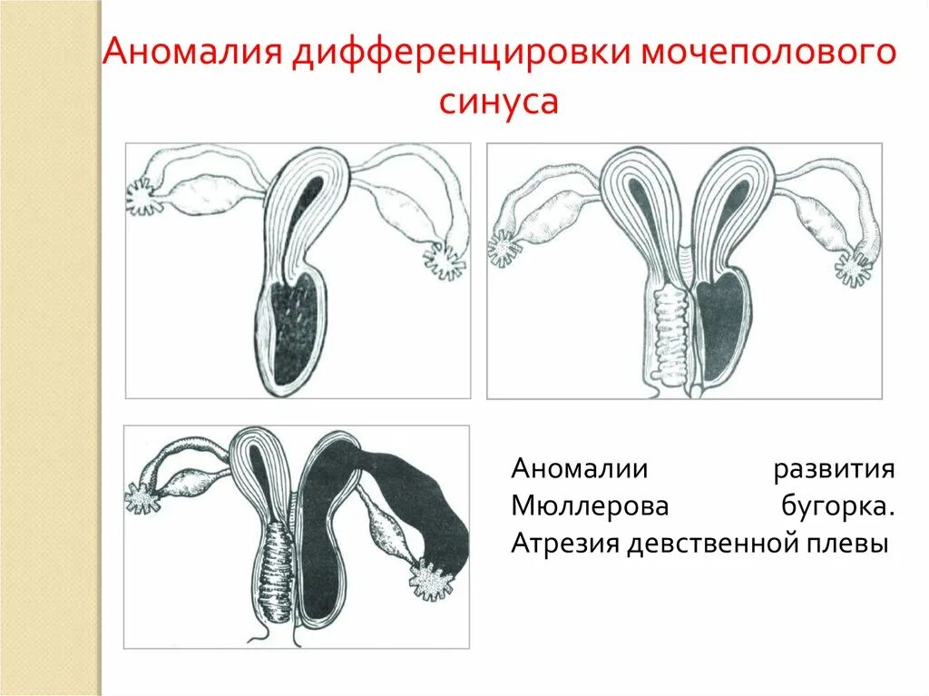 Половая система человека презентация. Операция по смене пола схема. Схема полового акта. Аномалии развития половых органов. Половые органы при смене пола.