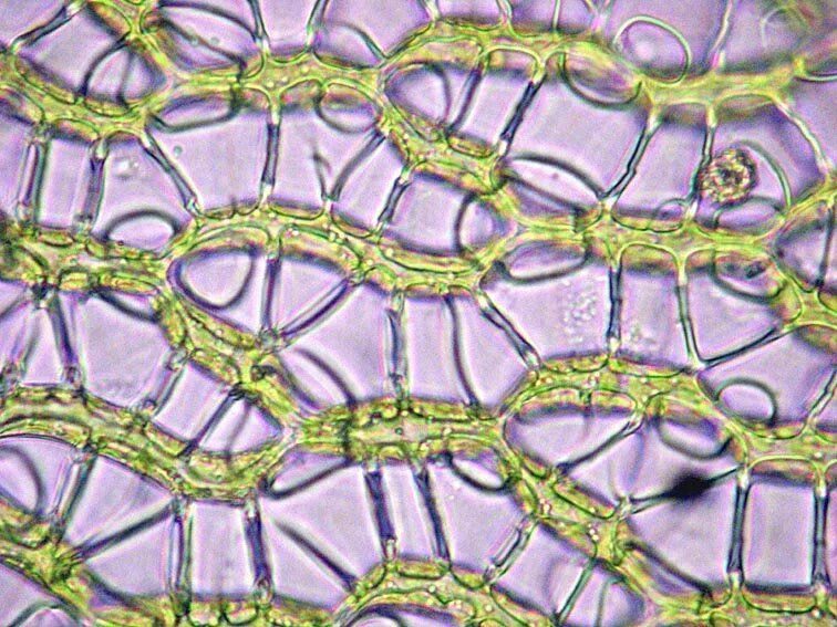 Водоносные клетки в листьях имеет. Аэренхима ткань растений. Клетки сфагнума под микроскопом. Водоносная ткань сфагнума. Аэренхима сфагнума.
