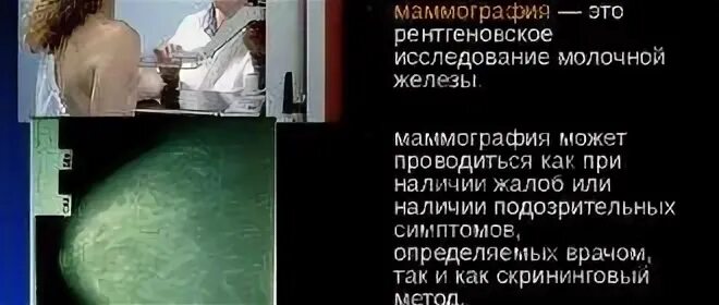 Со скольки лет можно делать маммографию