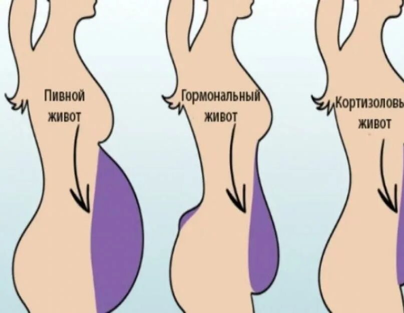 Бок хотя. Формы живота у женщин. Пивной живот гормональный живот. Гормональный живот у женщин. Выпячивает живот при беременности.