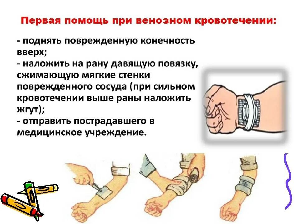 Алгоритм оказания неотложной помощи при наружном кровотечении. Алгоритм оказания первой медицинской помощи при кровотечениях. Оказание первой помощи при артериальном и венозном кровотечении. Алгоритм 1 помощи при сильном кровотечении. Очередность оказания первой помощи при кровотечениях.