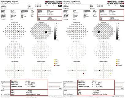 Расшифровка компьютерной периметрии
