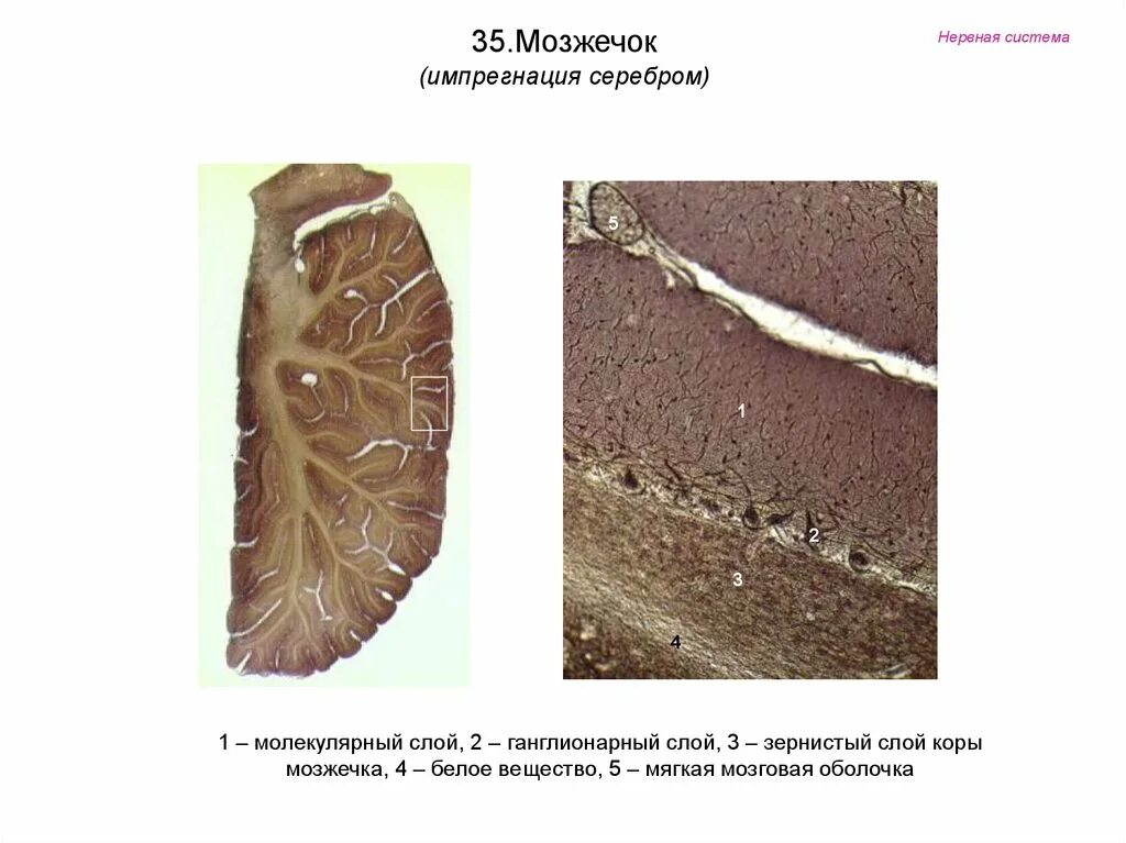 Ткань мозжечка. Мозжечок гистология препарат. Мозжечок препарат гистология импрегнация серебром. Препарат мозжечок импрегнация серебром.