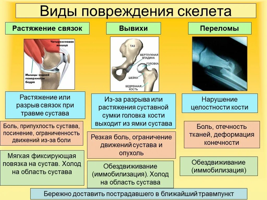 Помощь по биологии 8 класс. Ушиб растяжение перелом таблица. виды повреждения скелета таблица. вид повреждения вывих первая помощь признаки повреждения. таблица ушибы переломы вывихи.