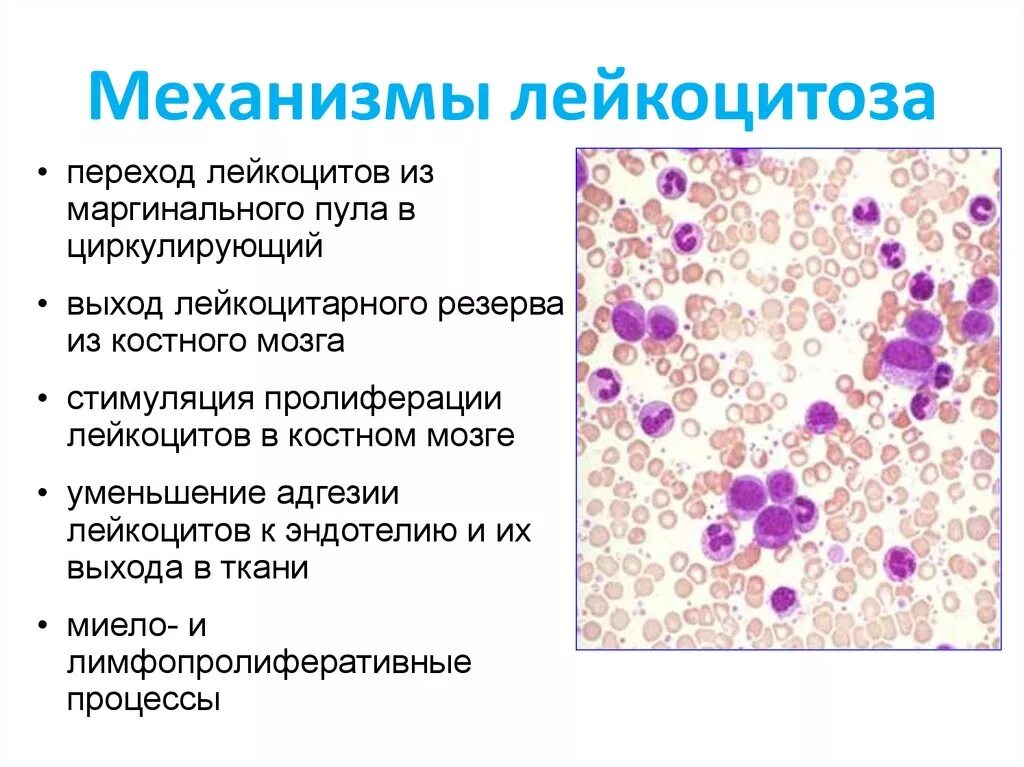 Лейкоцитарная реакция выражена