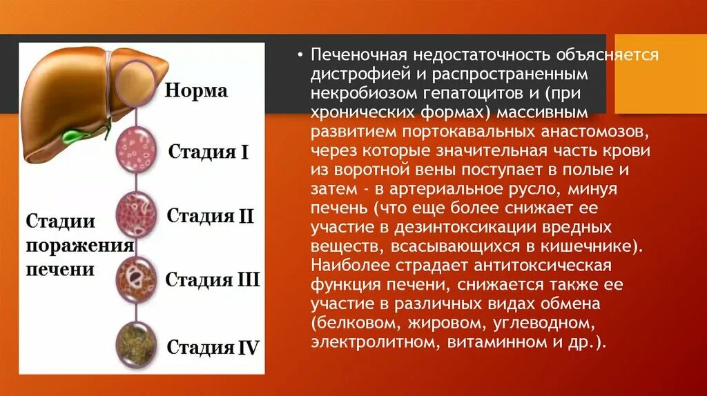 Хроническая недостаточность печени. Печеночнаямнедостаточность. Печеночная недостаточность. Недостаточность функции печени. Острая и хроническая печеночная недостаточность.