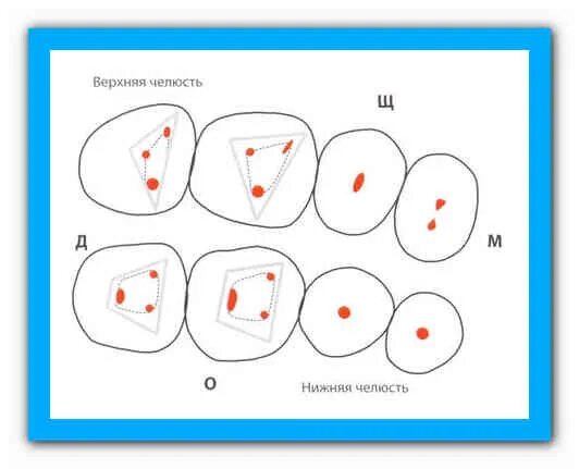 Расположение каналов в зубах схема. Расположение каналов в 16 зубе. Расположение каналов в нижней семерке. Количество каналов в зубах схема.