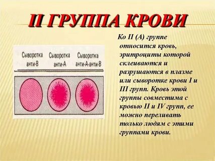 И т д вторая группа