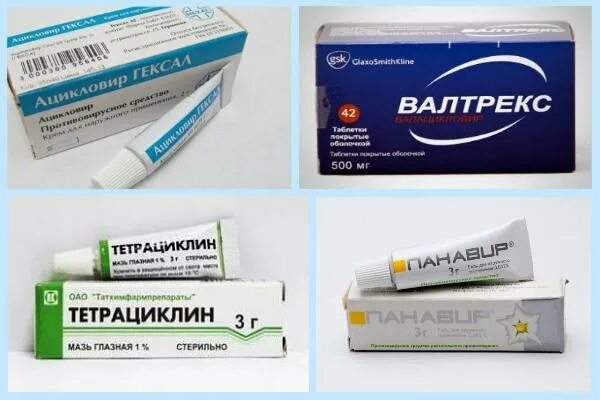 Лечение герпеса на губах таблетки. Таблетки и мазь от герпеса на лице. препараты от герпеса мазь.