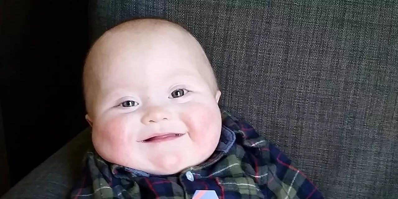 Медведь с синдромом дауна. Синдром Дауна. Ребенок даун. Лицо Дауна. Маленькие дети с лицом Дауна