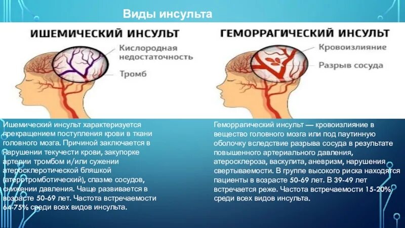 Ад при инсульте. Тромботический ишемический инсульт. Ишемический инсульт головного мозга. Артериальный ишемический инсульт.