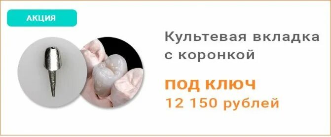 Что такое вкладки при протезировании