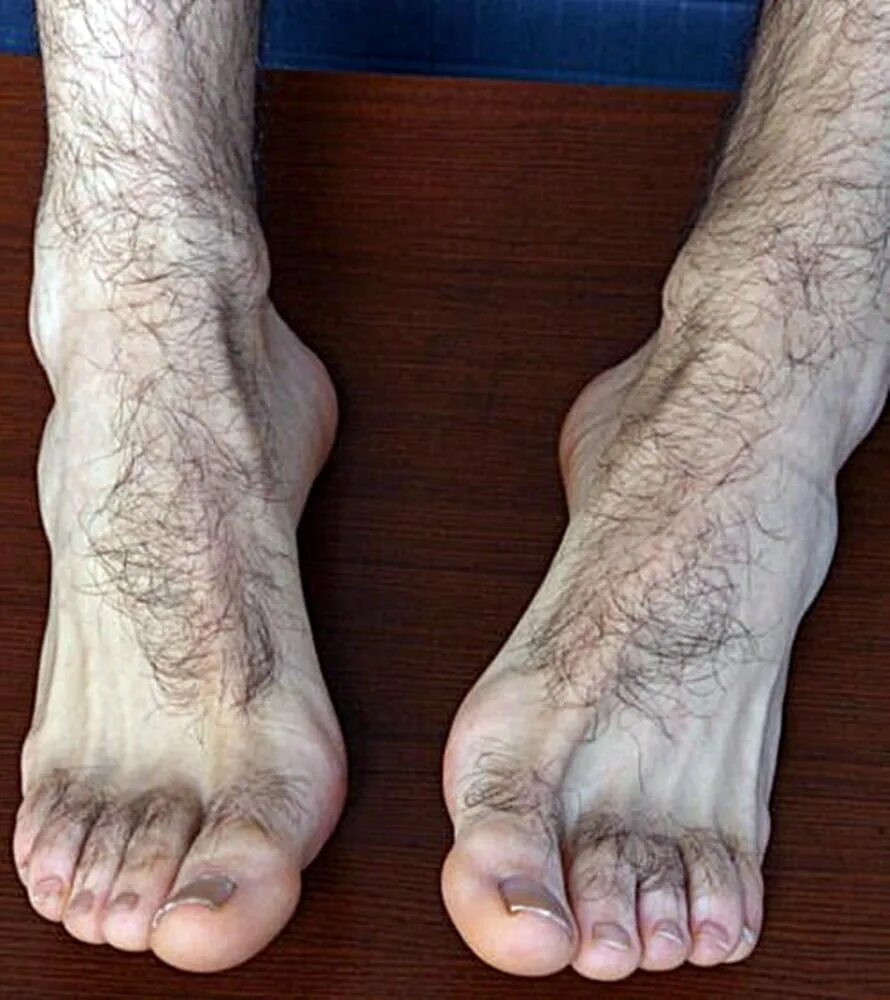 Hairy foot. Волосатые стопы желательно страшные. Волосатые стопы гномов.