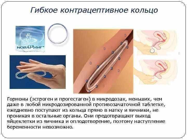 Новаринг кольцо кольцо вагинальное. Гормональное кольцо контрацептив. Гормональное кольцо контрацептив. Новаринг кольцо ваг 15мкг+120мкг №1 + 1 аппликатор. Кольцо n1 ваг +аппликат.