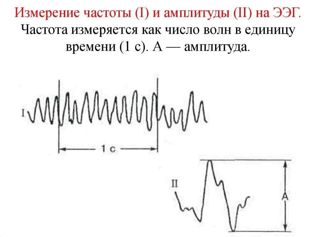 Частота ээг. Частота и амплитуда ЭЭГ. ЭЭГ колебания. Измерение частоты и амплитуды на ЭЭГ. Частота волн ЭЭГ.