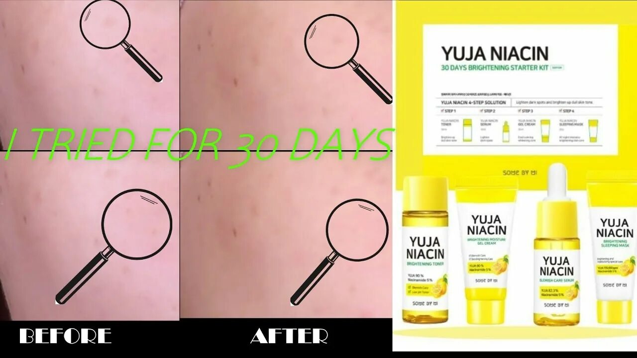 Some by mi starter kit. Yuja niacin starter kit. yuja niacin 30 days brightening starter kit. yuja niacin как пользоваться набором. some by mi.